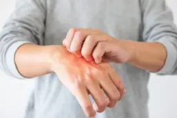 نشانه‌های پوستی که از بیماری خبر می‌دهند