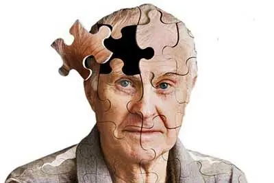 چطور با چند عادت ساده از آلزایمر فرار کنیم؟