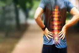 علائم و نشانه های ابتلا به دیسک کمر را بشناسید