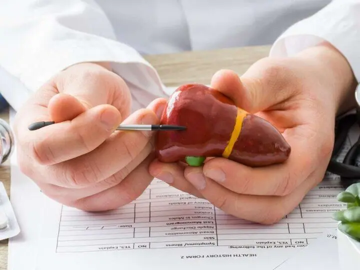 ۳ راهکار ساده برای پیشگیری از بیماری کبد چرب