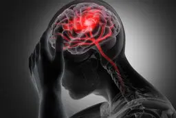 ۵ نشانه اولیه سکته مغزی که نباید نادیده بگیرید؛ چه باید کرد؟