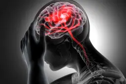 ۵ نشانه اولیه سکته مغزی که نباید نادیده بگیرید؛ چه باید کرد؟