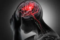 ۵ نشانه اولیه سکته مغزی که نباید نادیده بگیرید؛ چه باید کرد؟