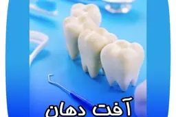 ۷ دلیل ابتلای مداوم به آفت دهان