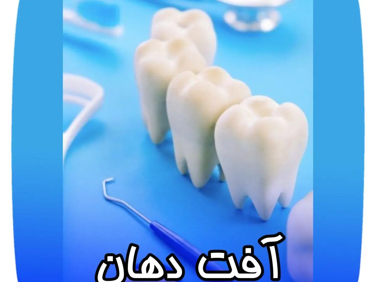 ۷ دلیل ابتلای مداوم به آفت دهان