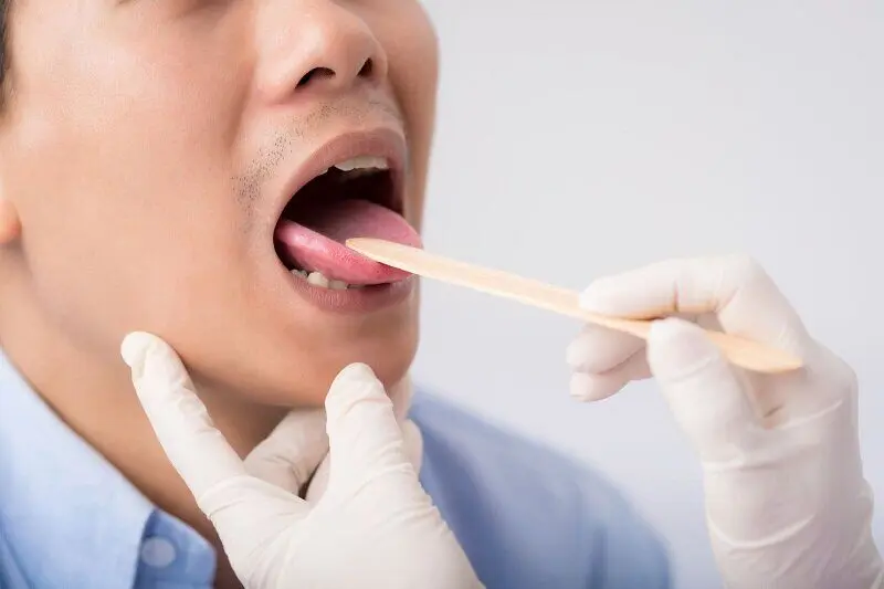ارتباط بین رنگ زبان و سلامت بدن / هر رنگ زبان نشانه چه بیماری است 
