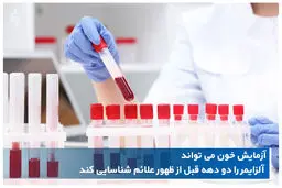 تشخیص آلزایمر و میزان پیشرفت آن با آزمایش خون