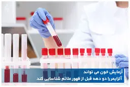 تشخیص آلزایمر و میزان پیشرفت آن با آزمایش خون