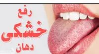 خشکی دهان نشانه این بیماری ها و عارضه این داروهاست