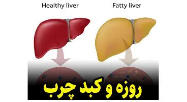 فواید روزه‌داری بر کبد چرب و دستگاه گوارش