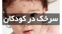 شیوع بیماری سرخک در کشور / واکسیناسیون کودکان را جدی بگیرید