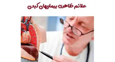 نشانه هایی که از بیماری‌های کبدی خبر می‌دهند