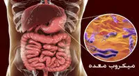 علائم وجود میکروب در معده + روش درمان