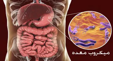 علائم وجود میکروب در معده + روش درمان