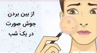 عوامل ایجاد جوش صورت/ یک شبه جای جوش را درمان کنید