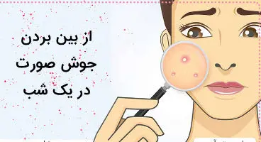 عوامل ایجاد جوش صورت/ یک شبه جای جوش را درمان کنید