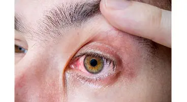 تشخیص هفت بیماری خطرناک از روی چشم
