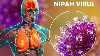 هشدار سازمان بهداشت جهانی؛ با ویروس مرگبار نیپا آشنا شوید