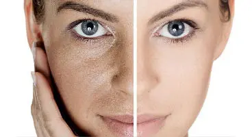 بیماری‌های خطرناکی که از روی صورت مشخص می‌شوند