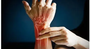 چند نکته ساده و کاربردی برای مقابله با "پوکی استخوان"