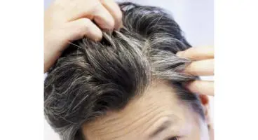 چند گام آسان برای کاهش سفیدی زودرس موی سر