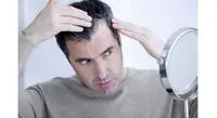 توصیه‌های تغذیه‌ای برای جلوگیری از ریزش مو