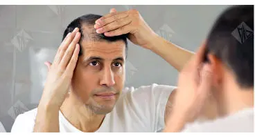 این غذاها ریزش مو را زیاد می‌کنند