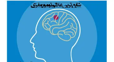علائم ونشانه های هشدار دهنده تومور مغزی
