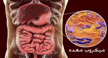غذاهایی که میکروب معده را از بین می‌برند