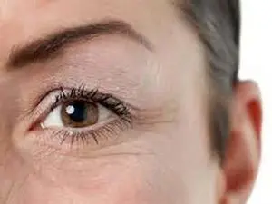 ۹ علت پیری زودرس پوست چیست؟