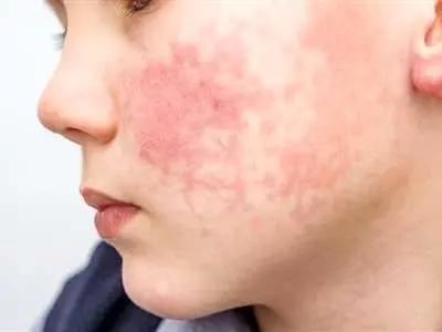 صورتتان درباره سلامتی شما چه می گوید؟