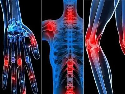 ۱۰ راهکار برای افزایش تراکم استخوان‌ها