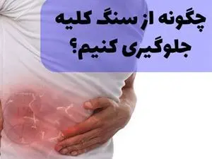 چه کار کنیم سنگ کلیه نگیریم؟