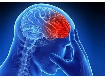 ۸۰ تا ۹۰ درصد سکته‌های مغزی قابل پیشگیری است
