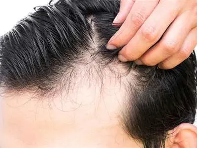 8 ماده غذایی تقویت کننده مو را بشناسید