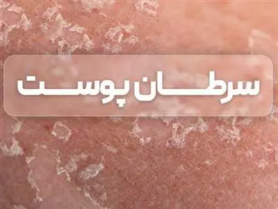 علائم سرطان پوست چیست؟