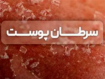 علائم سرطان پوست چیست؟