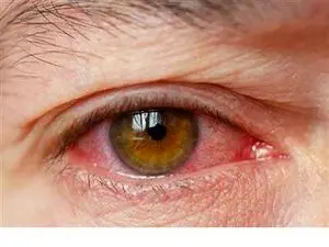 تشخیص مشکلات کبدی از ظاهر افراد