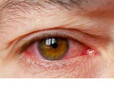 تشخیص مشکلات کبدی از ظاهر افراد