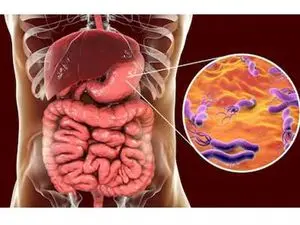علائم میکروب معده+اینفوگرافی
