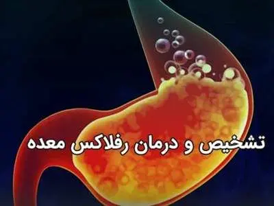 اگر رفلاکس معده دارید بخوانید