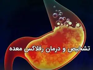 اگر رفلاکس معده دارید بخوانید