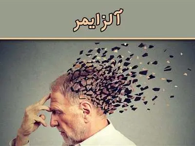 علائم ابتلا به آلزایمر که در خانه بیمار نمایان می‌شود