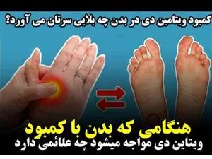 علائمی که نشان می‌دهند کمبود ویتامین D دارید/ ۵ روش برای تامین این ویتامین