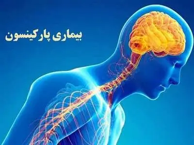 ۷ عامل تشدید کننده پارکینسون