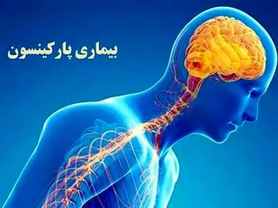 ۷ عامل تشدید کننده پارکینسون