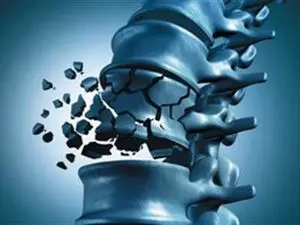 برای تقویت استخوان از این ۱۱ خوراکی نگذرید