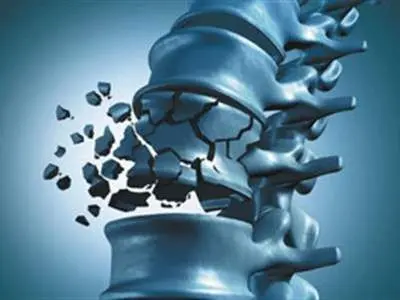 برای تقویت استخوان از این ۱۱ خوراکی نگذرید