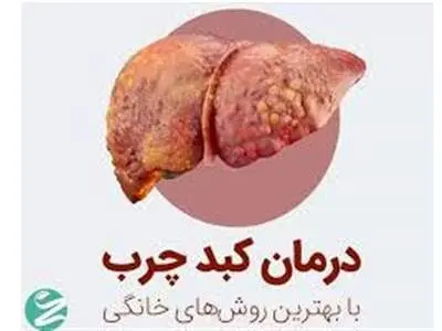۴ روش معجزه آسا خانگی برای درمان کبد چرب