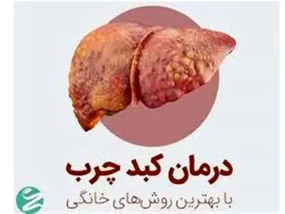 ۴ روش معجزه آسا خانگی برای درمان کبد چرب